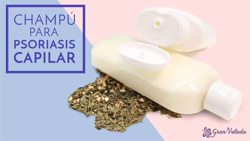 Champu para psoriasis: receta casera y natural. ¡Facil de hacer!